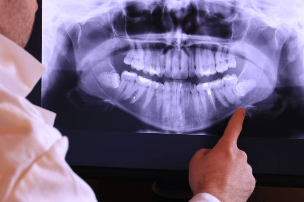 Best Emergency Tooth Extraction in Shinnston, WV