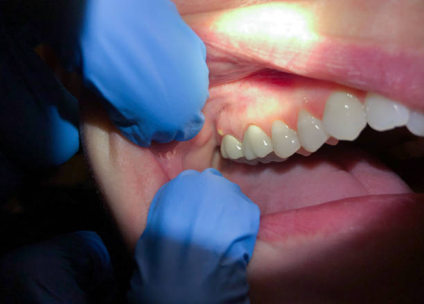 Best Same-Day Emergency Dental Services in Shinnston, WV